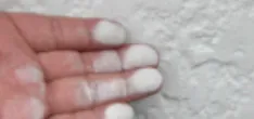 粉ふき（チョーキング）